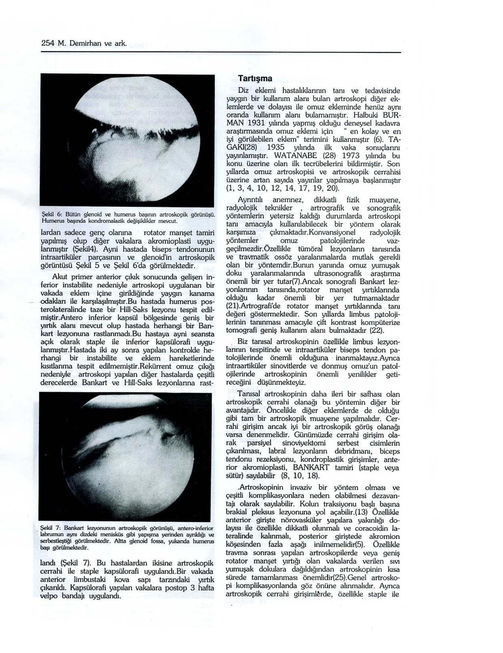 254 M. Demirhan ve ark. Şekil 6: Bütün glenoid ve humerus başının artroskopik görünüşü. Humerus başında kondromalaıik değiş i klikler mevcut.