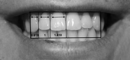 50 Kurt A., Işık Özkol G. Giriş Diş hekimleri ve hastaları için estetik diş hekimliği giderek artan bir öneme sahiptir (1, 2).
