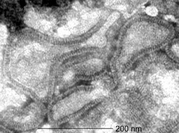 hmpv zarflı, tek zincirli bir RNA virusu Metapneumovirus cinsi,