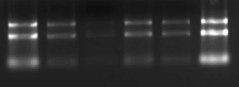 60 Yürütme sonunda 28S, 18S ve 5S RNA görüntüsü net bir biçimde gözlenmiştir.