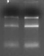 2). 28 S 18 S 5 S 28 S 18 S 5 S Şekil 2.2. Farklı zamanlarda hücre kültüründen elde edilen RNA örneklerinin genel görüntüsü RNA nın kantitasyonu RNA miktarının ölçümü Qubit marka (Invitrogen) mini florometre ile yapılmıştır.