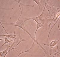 78 Şekil 3.8. Glia kökenli hücrelerin GFAP ile gösterimi-3 (sol normal sağ aynı hücrenin