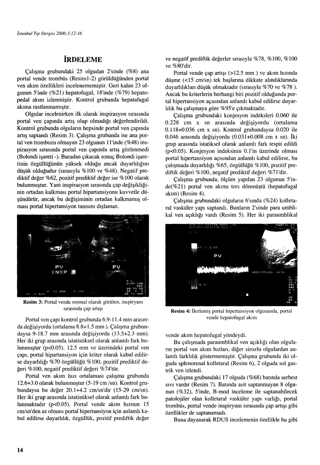 İstanbul Tıp Dergisr 2006:3;12-16 İRDELEME Çalışma grubundaki 25 olgudan 2'sinde (%8) ana porta! vende trombüs (Resiml-2) görüldüğünden porta! ven akım özellikleri incelenememiştir.