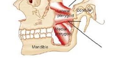 İç ve dış pterigoid kaslar Lateral Pterygoid Medial Pterygoid Superior lateral pterigoid kas superior lateral
