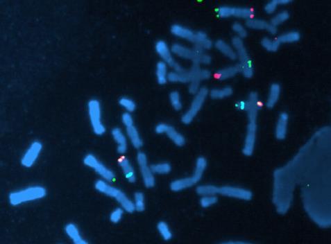 Kullanımı: Kromozomlardaki sayısal ve yapısal değişikliklerin saptanmasına olanak tanır.