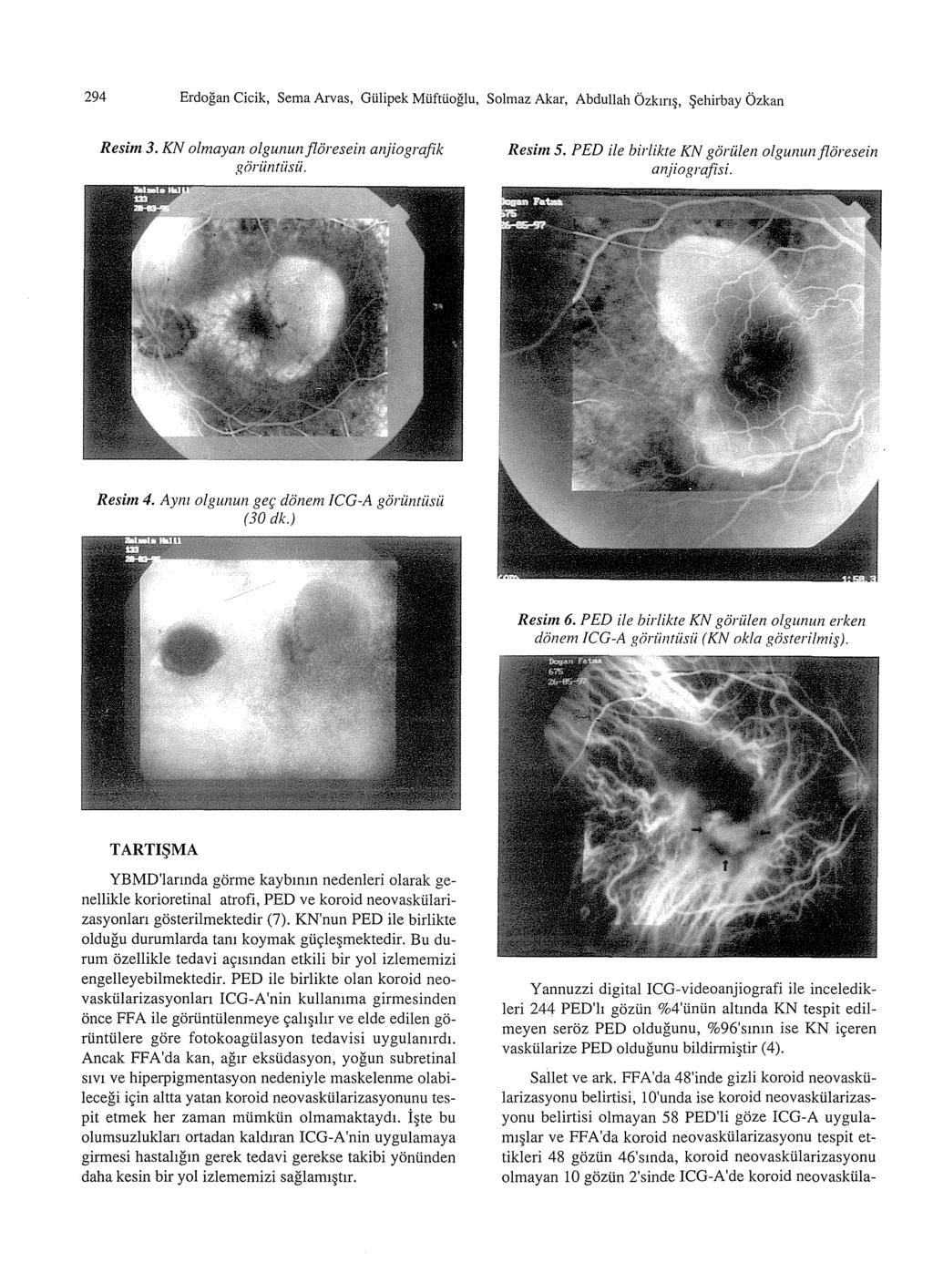 294 Erdogan Cicik, Serna Arvas, Gtilipek Mliftlioglu, Solmaz Akar, Abdullah Ozkm, ~ehirbay Ozkan Resim 3. KN olmayan olgununfloresein anjiografik goriintiisii. Resim 5.