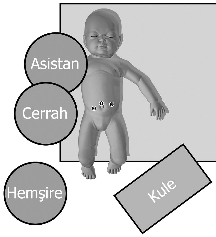 literatür bilgisi ile değinilecektir. Üreter MP, ogmentasyon sistoplastisi ile de kombine edilebilir.