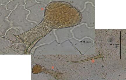 Kutikulası noktacıklı, tek hücreli, uzun örtü tüyleri görülür ve alt epidermaya göre daha