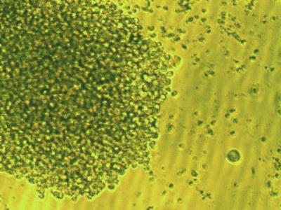 Çöken hücrelere seçici kültür ortamı ilave edilerek bir önceki gün makrofaj ekilmiş hücre kültür plaklarına 150 µl /kuyu olacak şekilde dağıtılır (Şekil 9).