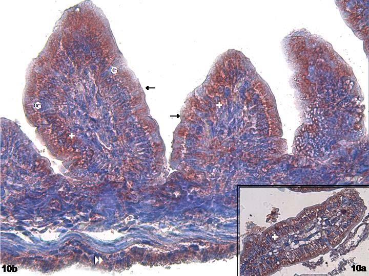 Resim 10: Yeni doğan grubunda Leptin antikoru ile yapılan immunohistokimyasal incelemelerinde küçük ve büyük büyültmeli resimlerde duedonum yüzey epitel hücrelerinin bazalinde (+) yoğun sitoplazmik