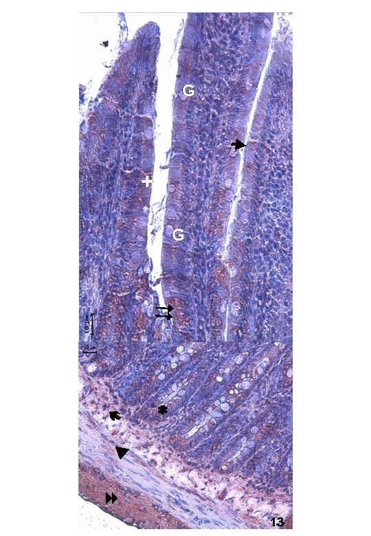 Resim 13: 8 aylık grupta alınan duodenum kesitlerinde leptin antikor ile yapılan incelemelerde bazı yüzey epitel hücrelerinde (+) oldukça yoğun, bazılarında oldukça zayıf sitoplazmik ( )