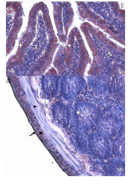 Resim 14: 22 aylık yaşlı grupta leptin antikor incelemelerinde villus epitelinde (+) diğer gruplardan ayrıcalı olarak son derece kuvvetli yaygın leptin tutulumu gösterdiği dikkati çekiyor.