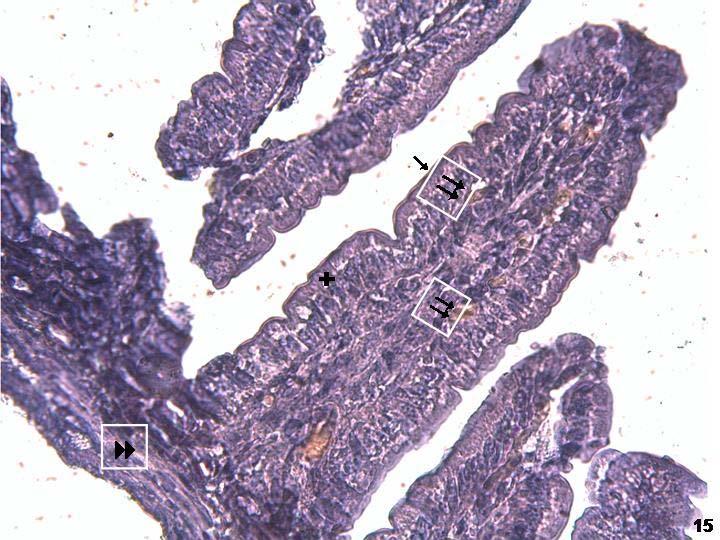 Resim 15: Yeni doğan grubunda (1 günlük) duodenumda leptin reseptör antikor incelemesinde tutulumun yüzey epitel hücrelerinde (+) apikal sitoplazmik ve zar ( ) düzeyinde olduğu izleniyor.