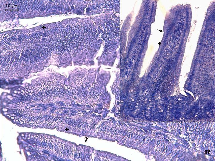 Resim 17: 22 günlük gruba ait duodenum kesitlerinde leptin reseptörü ile yapılan incelemelerde küçük ve büyük büyültmeli resimlerde tutulumun