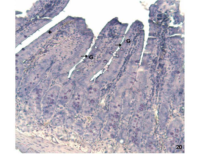 Resim 20: Aynı grupta duodenumda hem yüzey epitelinde (+) hem de goblet hücrelerinde (G) membranöz ( ) düzeydeki leptin reseptör tutulumu görülüyor.