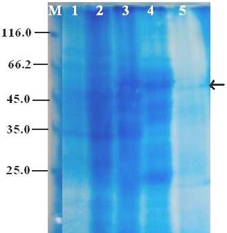 4. BULGULAR VE TARTIŞMA Bahri Devrim ÖZCAN Şekil 4.23. β-amilaz geni taşıyan bakterilere ait toplam proteinlerin SDS-PAGE de gösterilmesi: M: markır; 1: E.