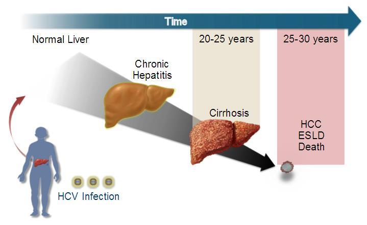 Hepatit C Kronik hepatit C (KHC) dünya çapında önemli bir sağlık sorunu Ölüm ve morbiditenin önde gelen