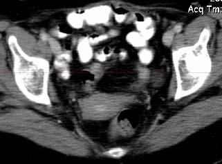 CT Organlar görüntülenebiliyor Kişiler arası farklılık daha