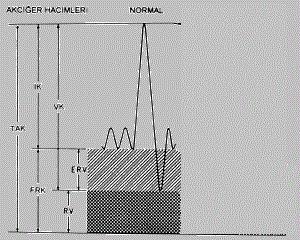 TAK: total akciğer kapasitesi; İK: inspiratuvar kapasite; FRK: fonksiyonel rezidüel kapasite; VK: vital kapasite; RV: rezidüel volüm; ERV: ekspiratuvar rezervuar volüm. Şekil 10.