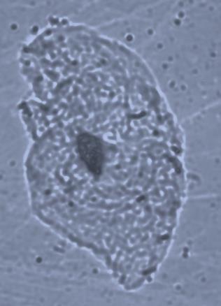 Albino Farelerde Bisfenol A Tarafından Teşvik a b n n mn Şekil 3.2. Yanak mukoza epitel hücrelerinde mikronukleusun görünümü, n: nukleus, mn: mikronukleus (a: kontrol grubu, b: uygulama grubu).