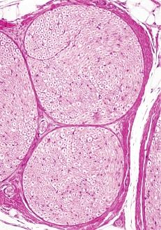 (Ross dan) Daha önce açıklandığı gibi, sinir hücrelerinin uzantıları olan aksonlar kendilerini saran kılıflarla birlikte sinir teli (sinir fibrili) adını alırlar.