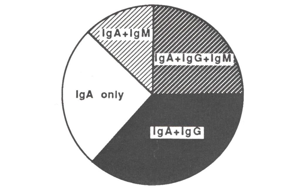 IgA nefropatisi - patoloji İmmünfloresan İmmünglobulinler Sadece IgA %26 IgA + IgG %37 IgA + IgM
