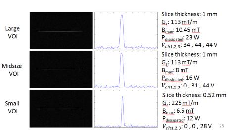 acquisition Ayarlanabilir Görüntüleme Alanı Feasibility of Z gradient Array for Variable Volume of Interest