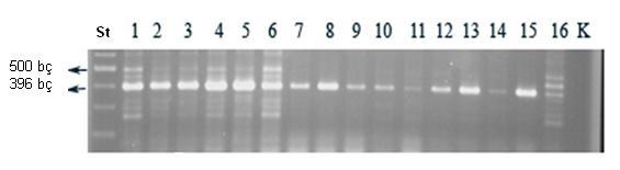 4. BULGULAR ve TARTIŞMA Metanet AKKUŞ ÇİFTCİ yapılmıştır. RT-PCR çalışmaları özellikle şırınga ile su testinde pozitif sonuç veren toplam 45 ağacın köklerinden izole edilen RNA dan yapılmıştır.