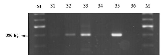 Balcalı-Kampüs, Kozan-Çukurköprü, Mersin-Dikilitaş ve Mersin-Iğdır gibi farklı bölgelerin farklı turunçgil bahçelerinden saçak kök örneklerinden yapılan RT- PCR analizleri.