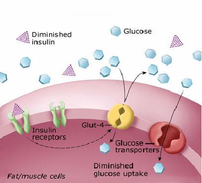 5 Şekil 1. Tip I diabetes mellitus: İnsülin eksikliği (7) 2.6.