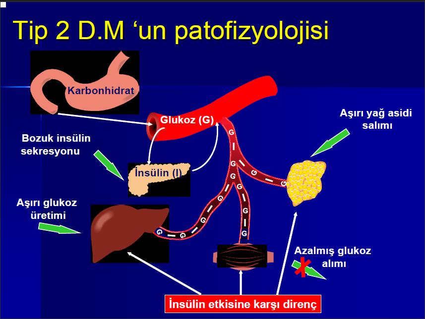 6 2.6.1. Patofizyolojisi NIDDM'de hiperglisemi iki bozukluğa bağlı olarak gelişir: 1- Karaciğer ve kas dokusunda oluşan insülin direnci 2- Pankreasta insülin üretiminin gittikçe azalması.