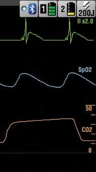 Bluetooth Kablosuz Aktarım İpuçları İPUÇLARI: Hedef cihaz bulunamazsa şunları kontrol edin: Hedef cihazın adı Hedef cihaz AÇIK ve aranabilir duruma ayarlanmış LIFEPAK 15 monitör Arama Filtresi ayarı