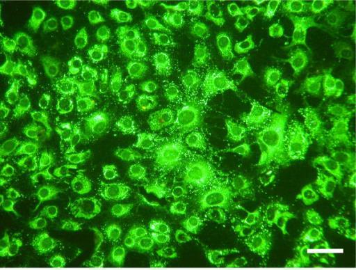 Indirect immunofluorescence test sonucu Indirect immunofluorescence microscopy performed on chicken sera with a neutralization