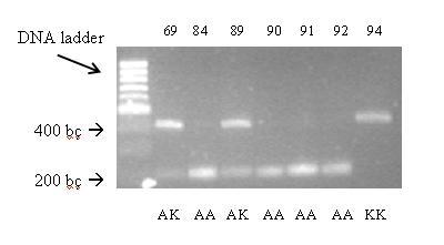 ġekil 3.2. DGAT1 geninin 10230 10644 gen bölgesinin PZR ürününün, CfrI restriksiyon enzimi ile kesim sonrası, agaroz jel fotoğrafı.