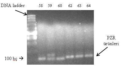 ġekil 3.3. PRNP geninin 49686 49776 (intron 1) nükleotidleri arasında bulanan bölgesinin PZR ürününün, agaroz jel fotoğrafı.