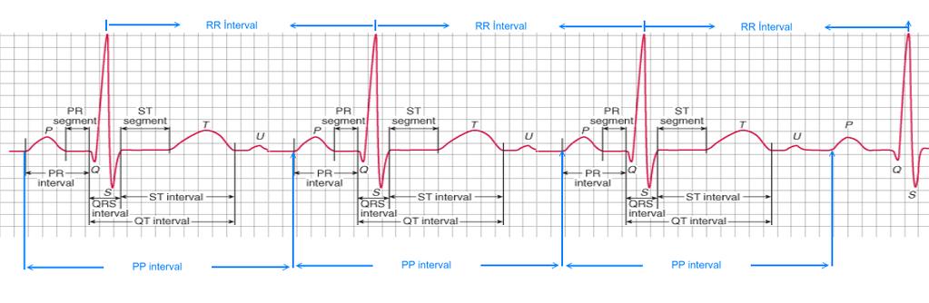 1 1. KALP HIZININ HESAPLANMASI EKG ile kalp hızının hesaplanması mümkündür. Hızı hesaplamadan önce ritmin düzenli ya da düzensiz olduğunun tespit edilmesi gerekmektedir. 1.1 KALP RİTMİNİN DÜZENİNİN BELİRLENMESİ Atriyal ritmin düzenini belirlemek için iki P dalgası arasındaki aralık işaretlenir.