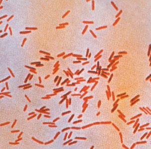 6 2.2. Salmonella Cinsinin Genel Özellikleri Enterobacteriaceae familyasının genel özelliklerini taşıyan Salmonella lar, Gram negatif, kısa ve küçük çomaklar tarzında olup, boyutları 0,7-1,5 x