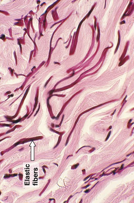 3-Elastik iplikler En az bulunan bağ doku ipliğidir Elastik kıkırdaklar, Ligamentum nuchae, elastik arterler, düz kasların tendonları, akciğer, deri