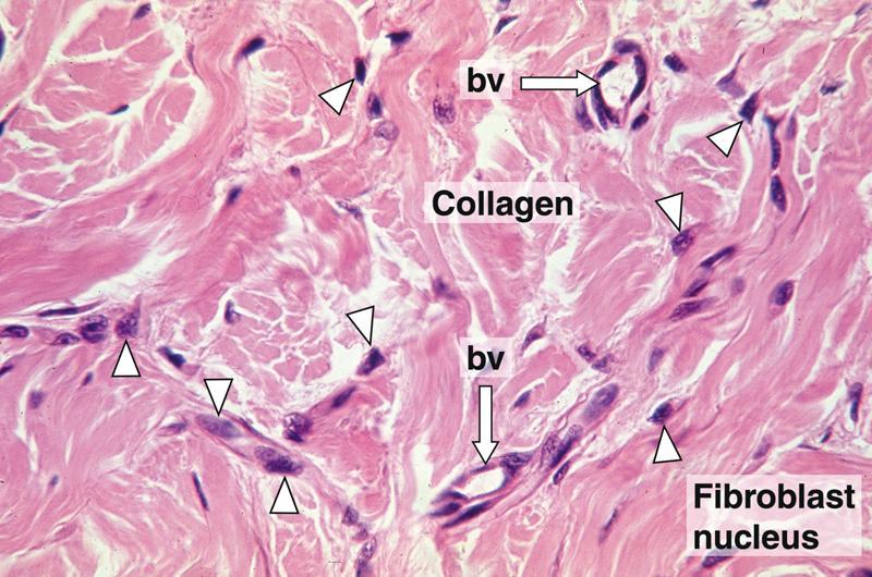 Dense irregular connective tissue from human dermis contains thick bundles of