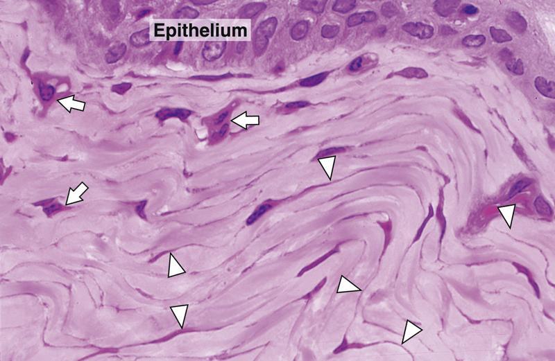 Section of immature dense irregular collagen tissue. This figure shows numerous fibroblasts (arrow) with many thin cytoplasmic extensions (arrowheads).