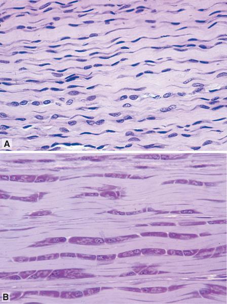 Longitudinal section of dense regular connective tissue from a tendon. A: Thick bundles of parallel collagen fibers fill the intercellular spaces between fibroblasts.