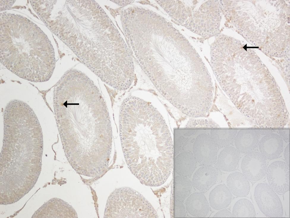 Kontrol grubu seminifer tübüllerde spermatogenezin farklı aģamalarındaki hücrelerde, az sayıda