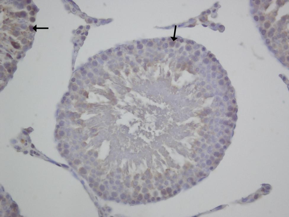 spermatogonyum ( ) ve spermatosit-1 de ( ) zayıf ve orta Ģiddetli immünpozitif reaktivite gösteren