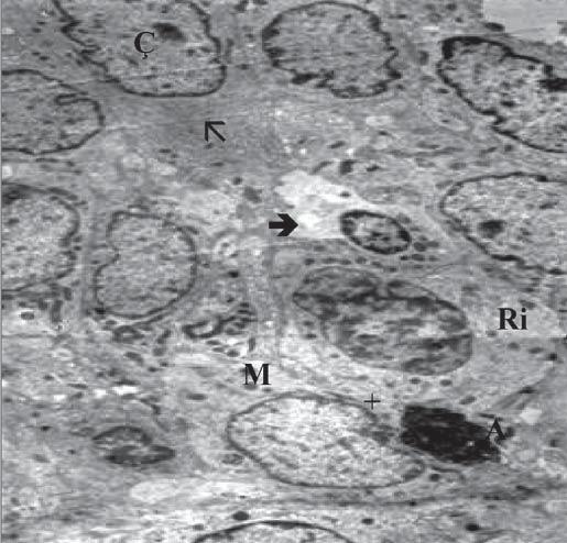 retikulum tubulusları gözlemlendi. Destek hücrelerinde ise bol miktarda kısa, dar tubuluslar halinde granülsüz endoplazmik retikulum ve serbest ribozomlar ayırt ediliyordu.