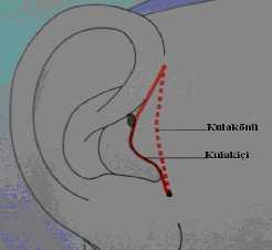 düzensizlikler üç farklı klinik düzenlemeyle tanımlanabilir 2-4. Bunlardan birincisi, primer fonksiyonel bozukluktur. Asıl sıkıntı fonksiyonla ilgilidir.