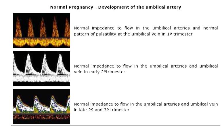 Umblikal arter dopler UA Dopler incelenmesi bir plasental