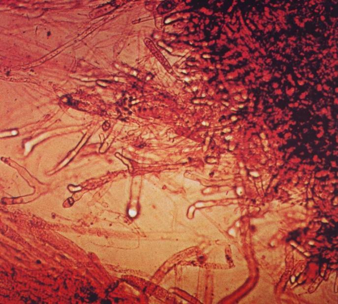 SAPROLEGNİASİS Oomycetes sınıfından olan Saprolegniaceae familyasına ait Saprolegnia parasitica Saprolegnia diclina.