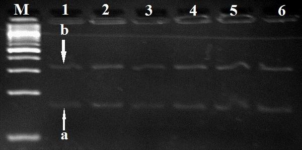 sonra tüpler 72 C de 5 dakika bekletilerek reaksiyona son verilmiştir. Elde edilen PCR ürünleri HaeIII restriksiyon enzimi kesilerek bireylerin genotipleri belirlenmiştir.