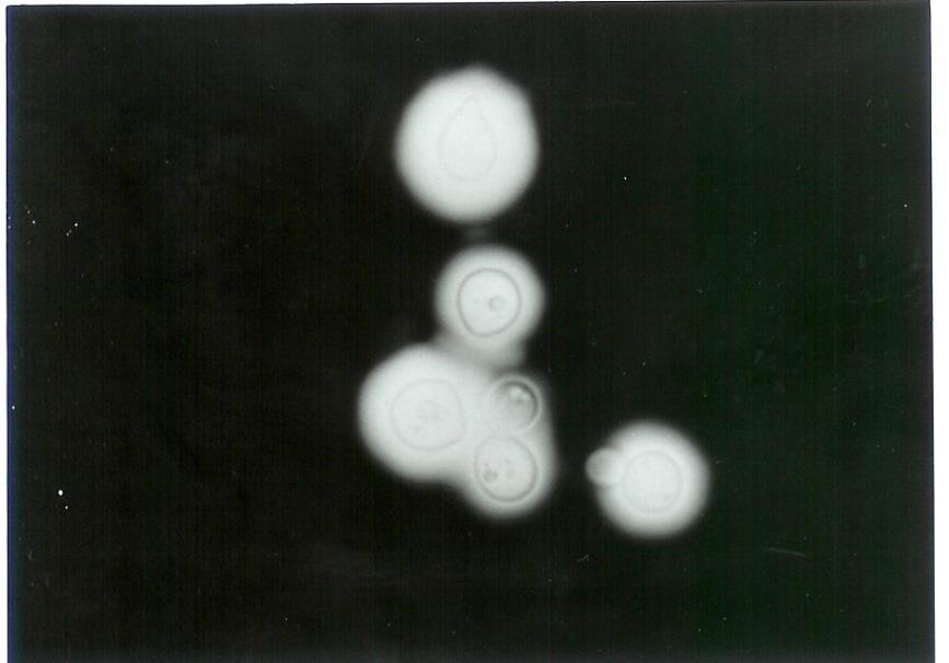 Kriptokok Ag Cryptococcus neoformans C neoformans ın dört serotipi (A,B,C,D) Cryptococcus albidus Polisakkarit yapıda