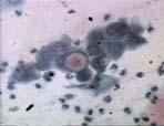 8. GİRİŞ Chlamydia trachomatis is the ethyologic agent of several common sexually transmitted bacterial pathologies.